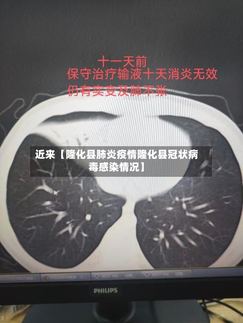 近来【隆化县肺炎疫情隆化县冠状病毒感染情况】-第2张图片